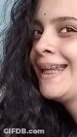 A Woman With Braces On Her Teeth Is Smiling For The Camera GIF