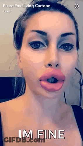A Woman With Very Large Lips Is Making A Funny Face And Saying Im Fine . GIF