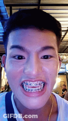 A Young Man With Braces On His Teeth Looks At The Camera GIF