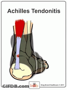 Achilles Tendonitis Diagram Bones And Muscles GIF