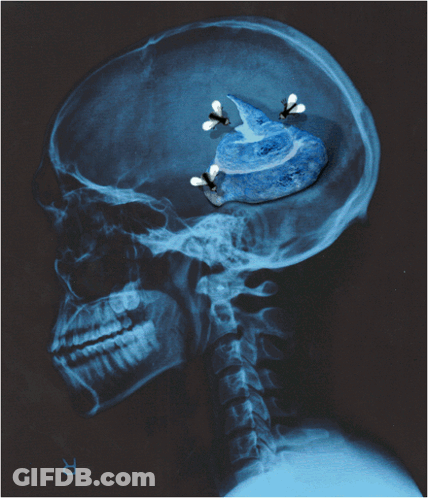 An X-Ray Of A Person 'S Head With The Letter R On The Bottom GIF