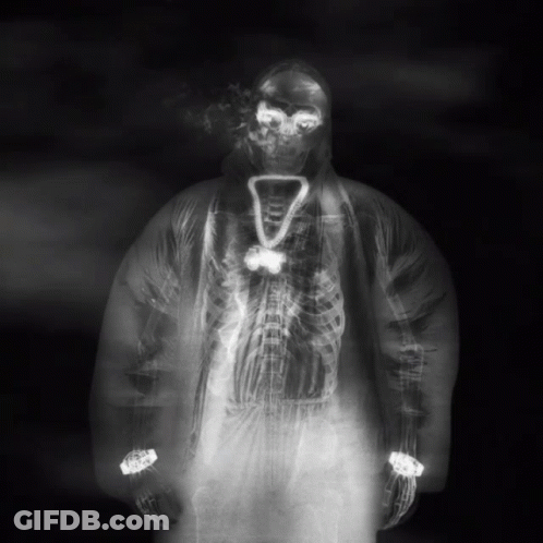 An X-Ray Of A Person With A Necklace That Says 7 GIF