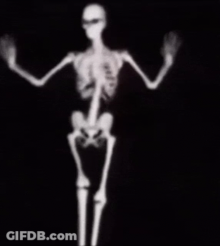 An X-Ray Of A Skeleton Dancing With Its Arms Outstretched . GIF