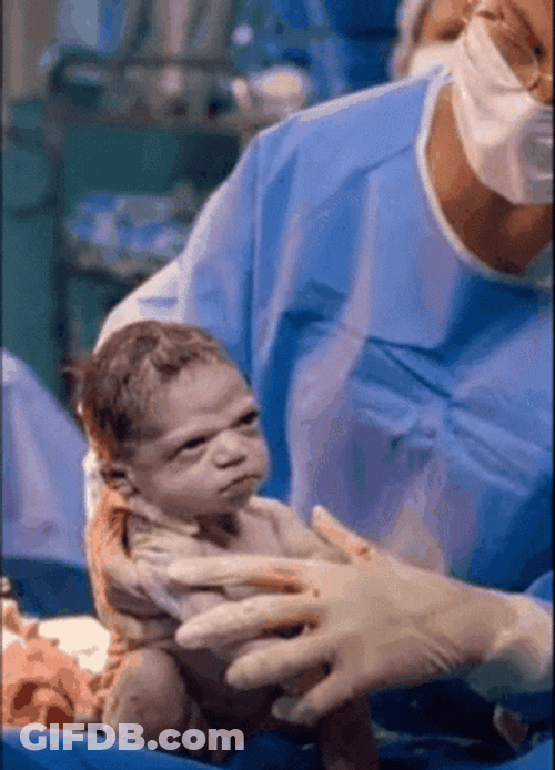 Angry Baby After Birth Meme GIF