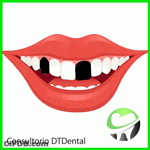 Animated Mouth Wide Smile With Missing Teeth GIF