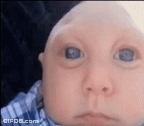 Baby With Blue Eyes Looking At Camera GIF