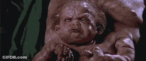 Baby With Huge Head Held GIF