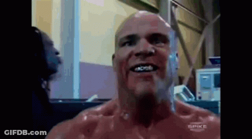 Bald Man With Braces Smiling At Spike Ad GIF