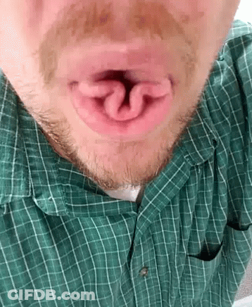 Bearded Man In Green Plaid Shirt Open Mouth GIF