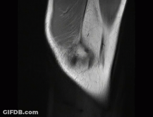 Black And White Elbow And Knee GIF