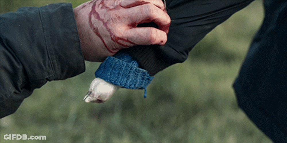 Blood Dripping On His Hand GIF
