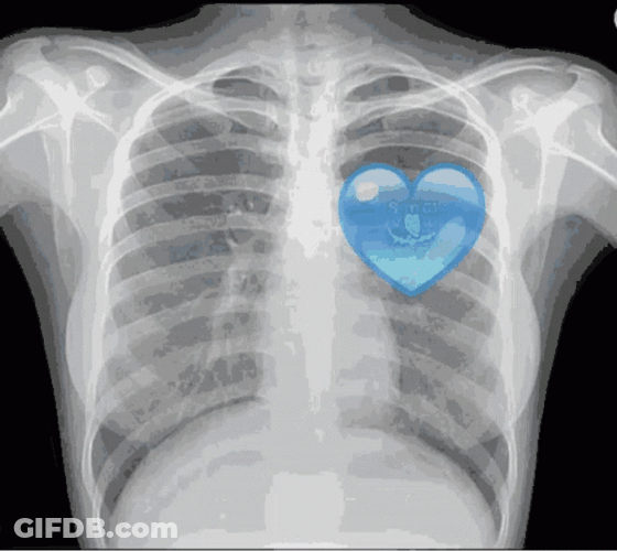 Blue Heart Xray GIF
