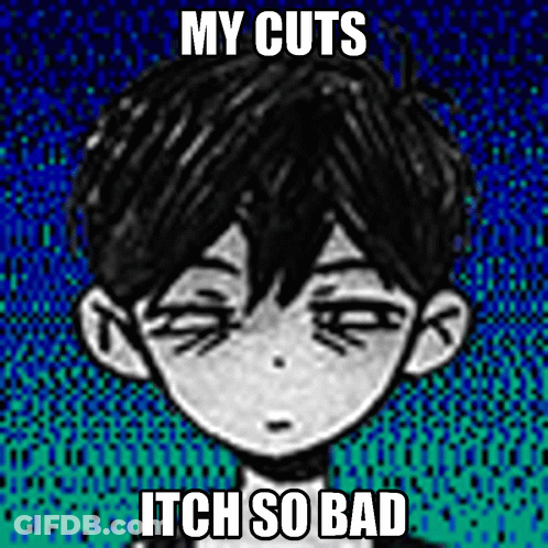 Boy Saying My Cuts Itch So Bad GIF