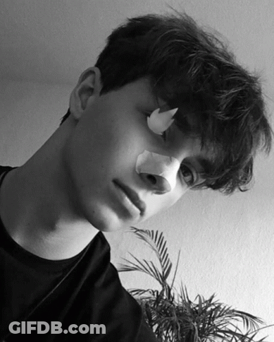 Boy With Bandage On Nose Looking At Camera GIF