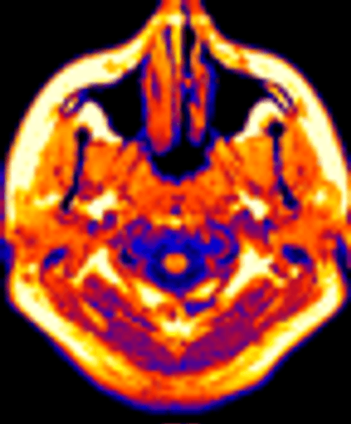 Brain Light Art GIF