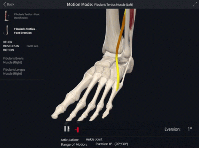 Broken Ankles Xray Results GIF