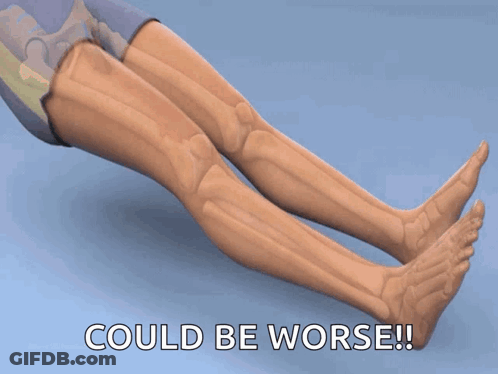Cartoon Leg Could Be Worse GIF