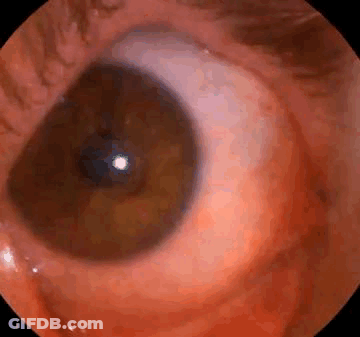 Close Up Eye With Blood Coming Out GIF