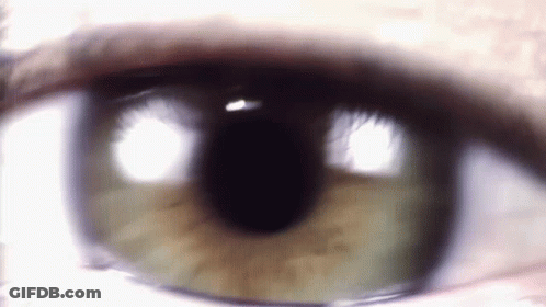 Close Up Eye With Few White Spots GIF