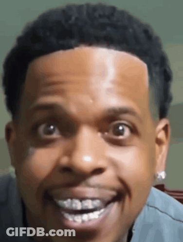 Close Up Man Smiling With Braces GIF