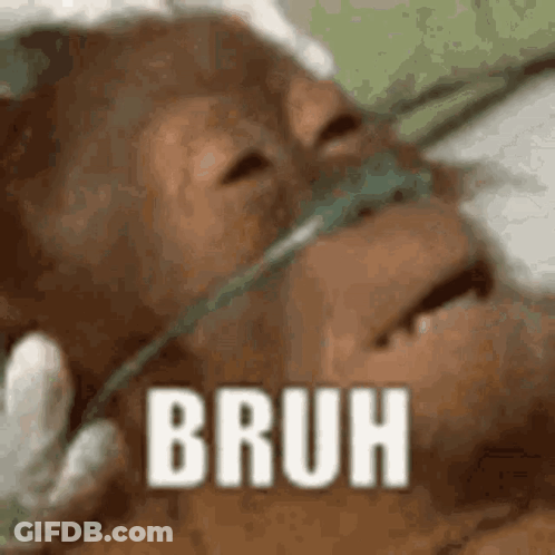 Close Up Monkey In Oxygen Mask Bruh GIF