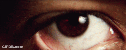 Close Up Of Brown Eye With White Pupil And Red Veins GIF
