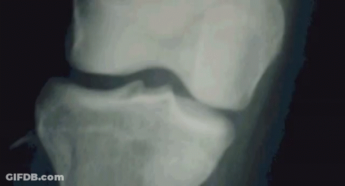 Close Up Of Cat Nose And Eyes GIF