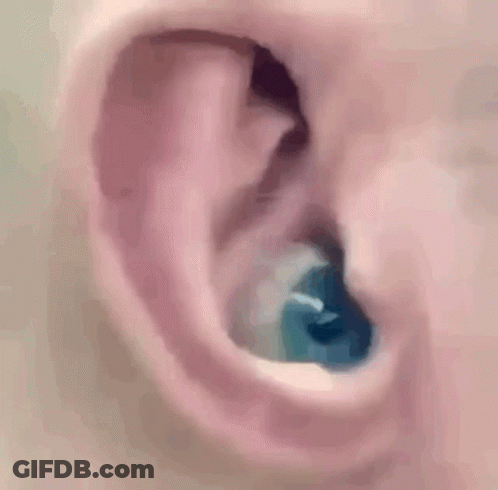 Close Up Of Ear With Blue Ear Plug GIF