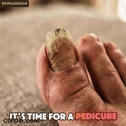Close Up Of Foot Saying It's Time For A Pedicure GIF