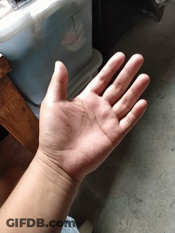 Close Up Of Hand With Spots GIF