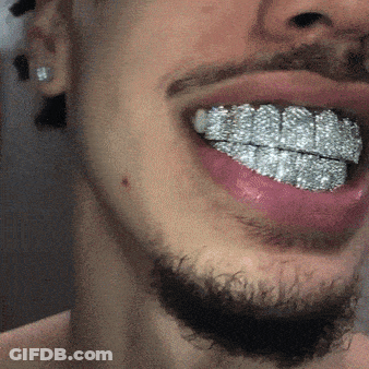 Close Up Of Man's Mouth With Diamond Teeth GIF