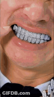 Close Up Of Man's Teeth With Diamonds GIF
