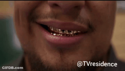 Close Up Of Man's Teeth With @Tvresidence GIF