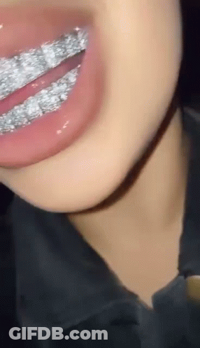 Close Up Of Mouth With Braces GIF