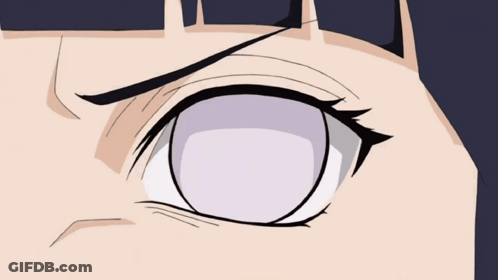 Close Up Of Person's Eye With White Pupil GIF
