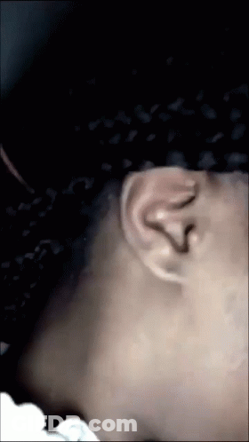 Close Up Of Person's Neck And Ear GIF