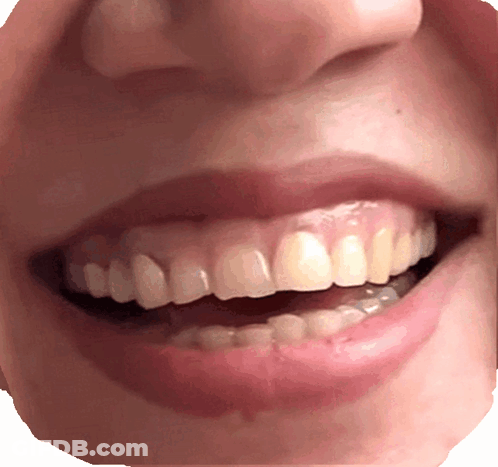 Close Up Of Woman Showing Teeth GIF