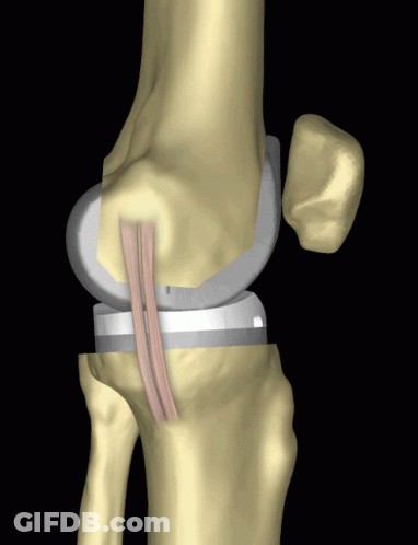 Computer Generated Knee Joint GIF