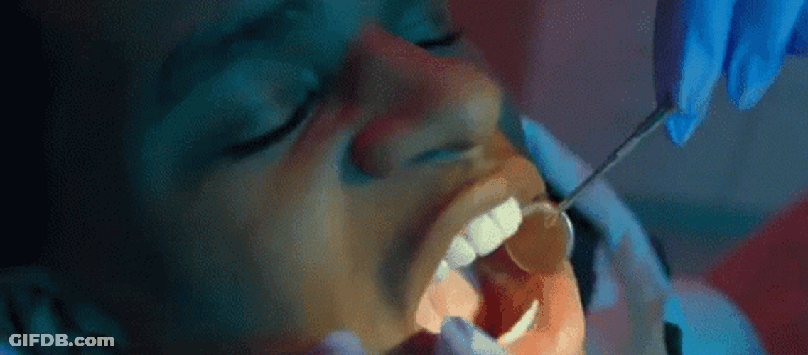Dentist Checking Teeth GIF