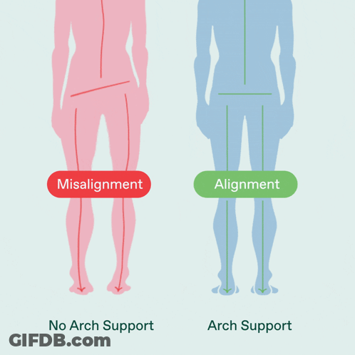 Diagram Person With Misalignment And Arch Support GIF