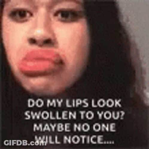 Do My Lips Look Swollen GIF