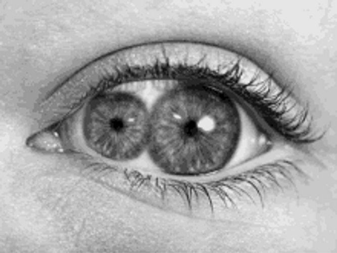 Double Lenses In Eyeball GIF