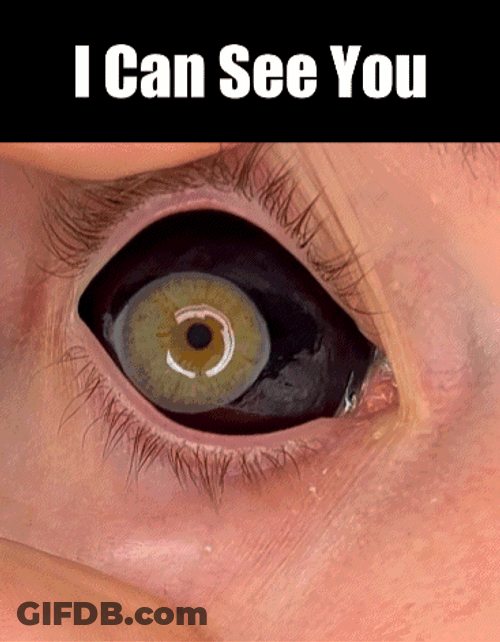 Eye To Eye I Can See You GIF
