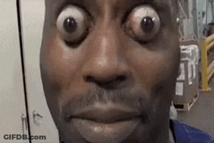 Eyes Popping Out Man Playing His Eyes GIF