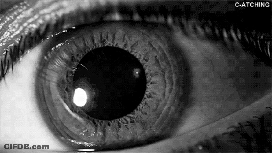 Eyes With Dilated Pupil GIF