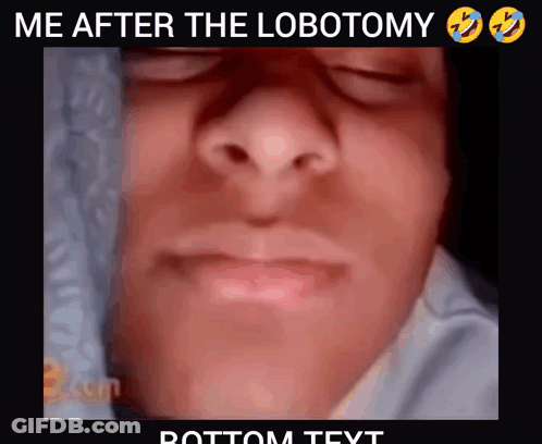 Face Saying Me After The Lobotomy GIF