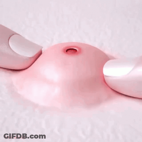 Fake Pimple Head Popping Out GIF