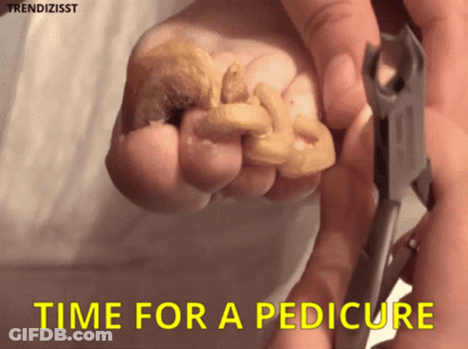 Feet In Need Of Pedicure GIF