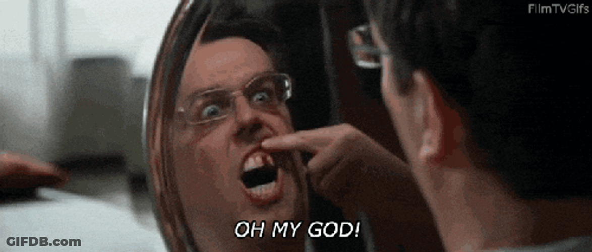 Flabbergasted About Missing Tooth GIF