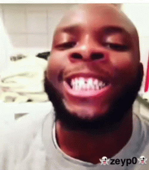 Funny Man Playing With Denture Missing Teeth GIF